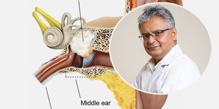 डाक्टरका कुरा : वर्खायाममा कान धेरै पाक्नुका कारण र उपचार विधि