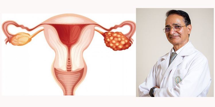 महिला प्रजनन् अंगमा हुने रोग समयमै पहिचान गरे निको हुन्छ : प्रा.डा पदमराज पन्त