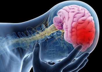 मस्तिष्कघातको निःशुल्क उपचारको तयारी