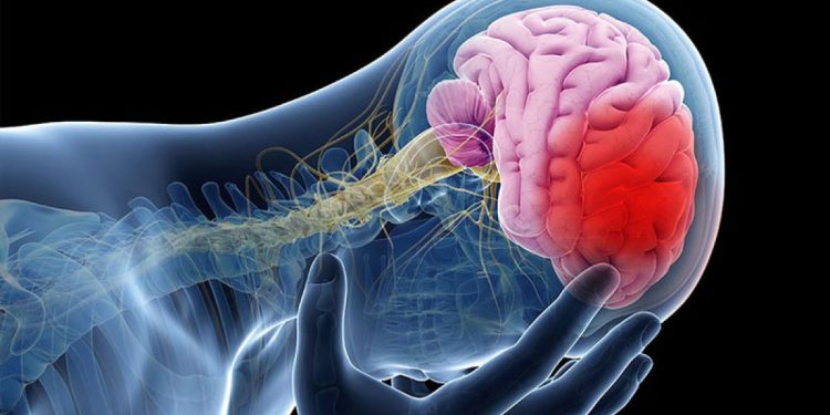 मस्तिष्कघातको निःशुल्क उपचारको तयारी