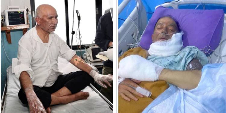 उपप्रधानमन्त्री पौडेल र मेयर आचार्यको भेटघाटमा अस्पतालले लगायो पूर्ण रोक