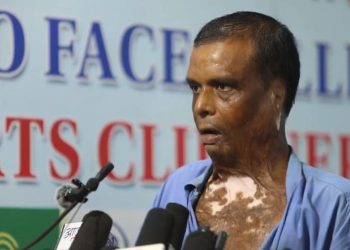 रौतहट बम विष्फोट घटनाः अफ्ताब छुटे, तर घाइते गौरीशंकरका घाउ अझै बल्झिरहेका छन्